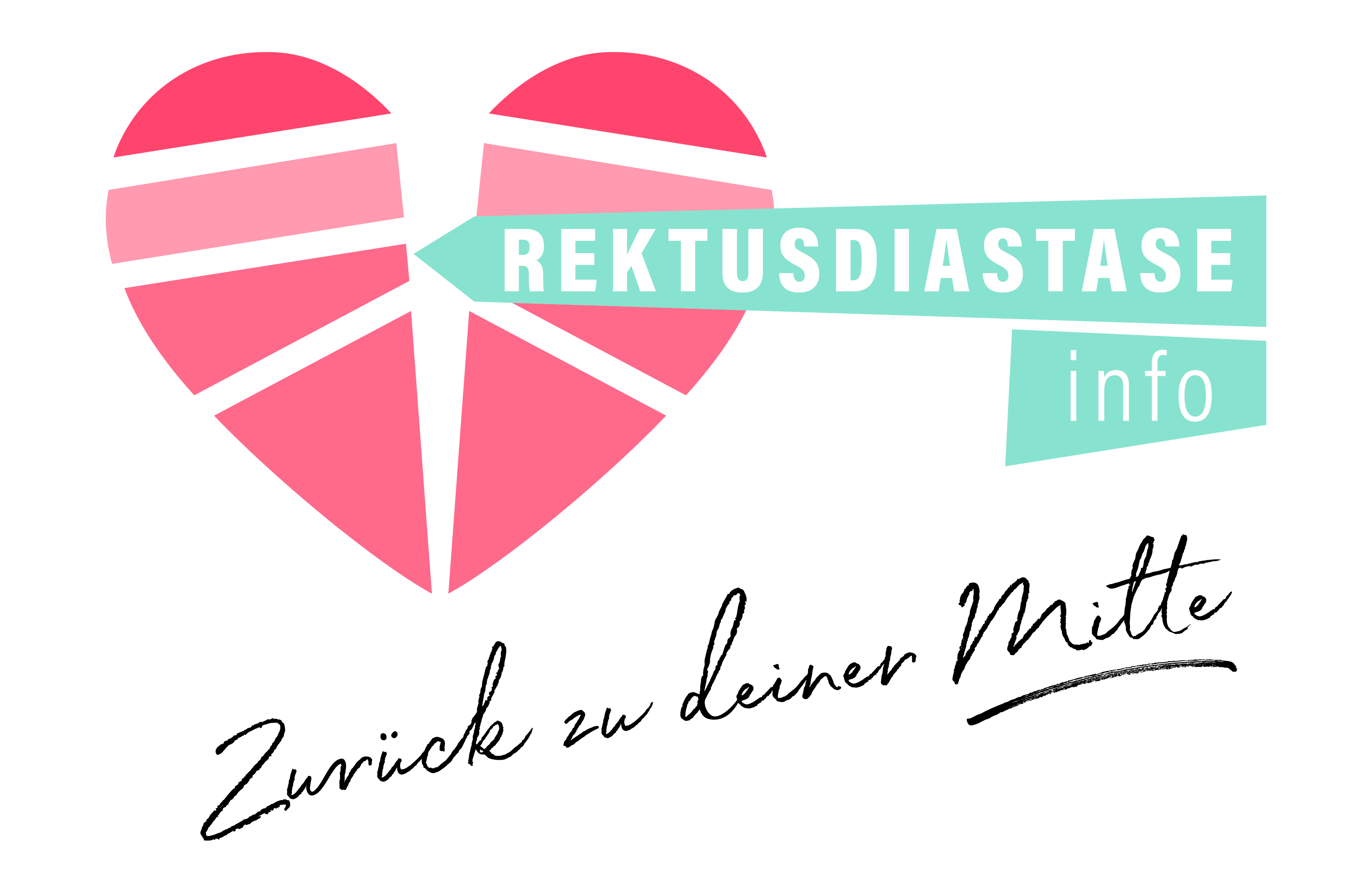 Rektusdiastase